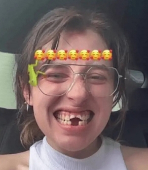 Angélica Rivera: Hija vive estrepitoso accidente, queda sin dientes