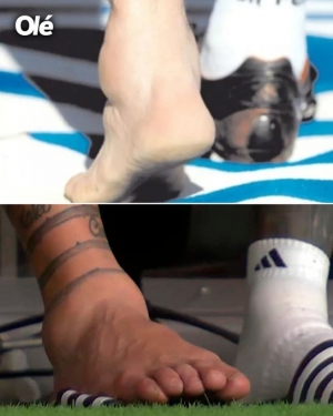 Así quedó el pie de Messi tras salir llorando de la final de la Copa América