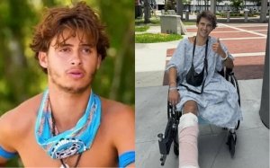 Participante de Survivor que perdi&oacute; una pierna en pleno programa demanda al reality por 100 millones de d&oacute;lares