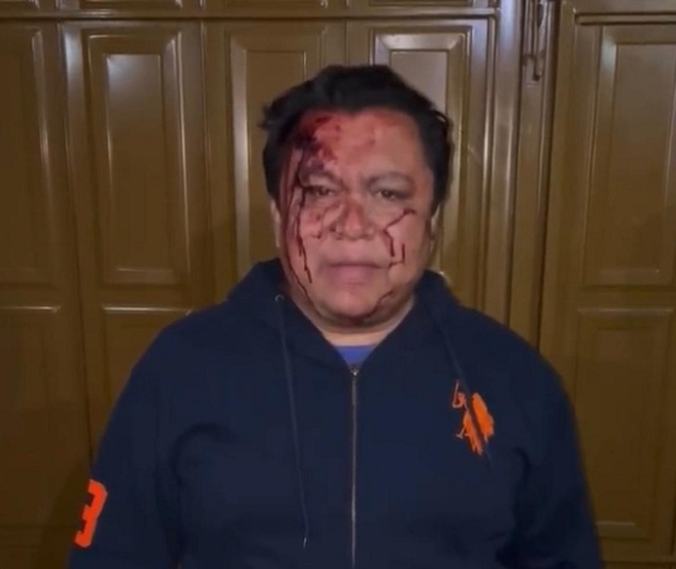 El líder sindical Gonzalo Juárez denuncia agresión de grupo armado en su casa