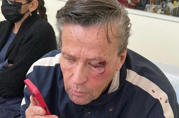 El actor Alfredo Adame denuncia que fue brutalmente agredido físicamente