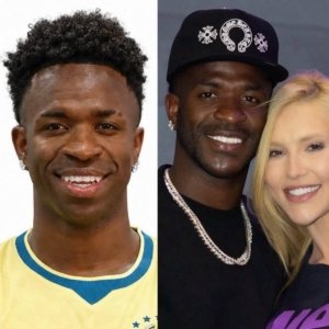&iexcl;Irreconocible! Vin&iacute;cius se opera el rostro y su nueva apariencia sorprende al mundo